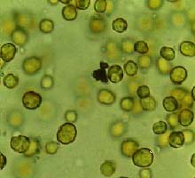 anemoni zooxantellae